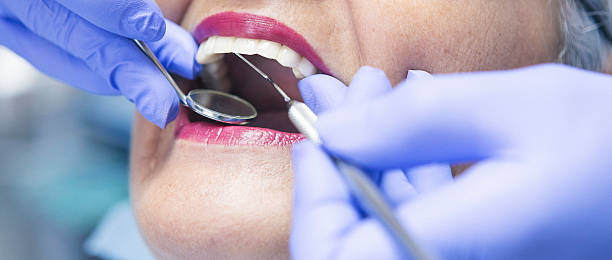 Best Emergency Treatment for Dental Infections or Abscesses in Cutler Bay, FL